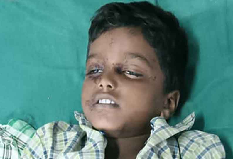 “அம்மா…எனக்கு உடம்பு சரியில்லை” தூங்கி கொண்டிருந்த சிறுவனுக்கு நடந்த விபரீதம்…. அதிர்ச்சியில் குடும்பத்தினர்…!!