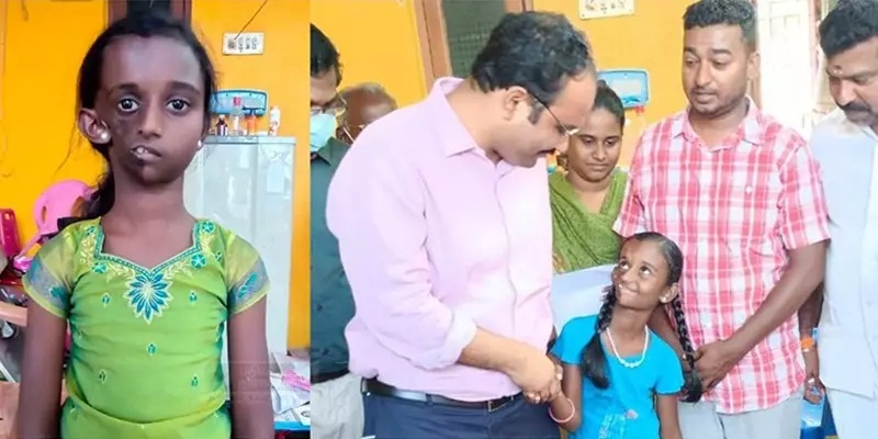 ஆவடி சிறுமிக்கு திங்கள்கிழமை அறுவை சிகிச்சை…!!