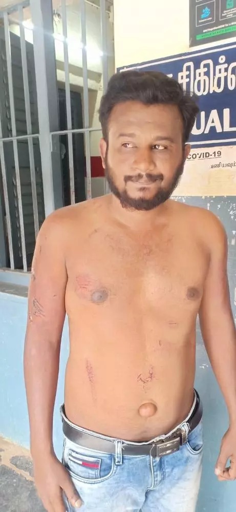 கட்டிட காண்ட்டிராக்டரை சித்திரவதை செய்து…. ரூ.5 லட்சம், நகை பறிப்பு…. போலீஸ் விசாரணை…!!!