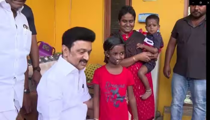 இந்த மனசு யாருக்கு வரும்!…. முகச்சிதைவு நோயால் பாதிக்கப்பட்ட சிறுமி…. முதல்வர் ஸ்டாலின் நெகிழ்ச்சி செயல்….!!!!