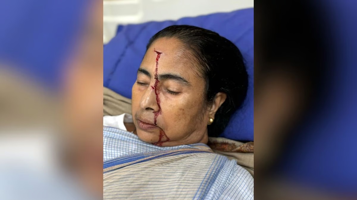 Mamata Banerjee Injured: மேற்குவங்க முதல்வர் மம்தா பானர்ஜிக்கு நெற்றியில் பலத்த காயம்… மருத்துவமனையில் அனுமதி!!