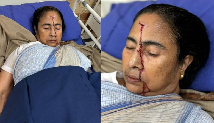 நெற்றியில் ரத்தம்.! மருத்துவமனையில் மேற்குவங்க முதல்வர் மம்தா பானர்ஜி… விரைவில் குணமடைய வேண்டும்…. தமிழக முதல்வர் ஸ்டாலின் உள்ளிட்டோர் பிரார்த்தனை.!!