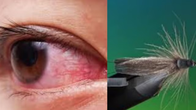 ஐயோ..! முகத்தை சுற்றிய பூச்சியை‌ அடிச்சது ஒரு குத்தமா…? கடைசில பார்வை போயிடுச்சே… பரிதவிப்பில் சீன வாலிபர்…!!!
