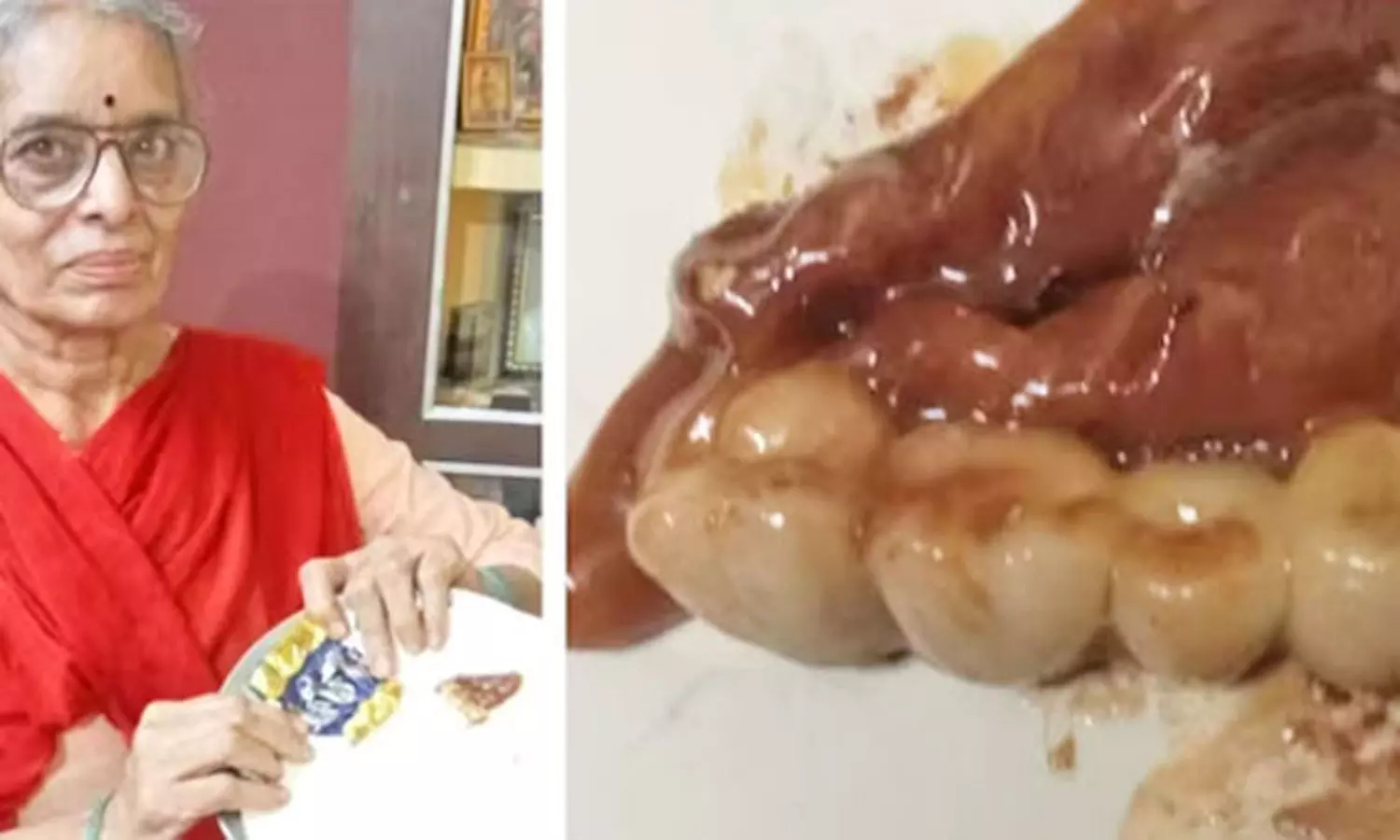 பிறந்தநாள் கொண்டாட்டம்…. ஆசையாக வாங்கிய சாக்லேட்டில் இருந்த “பல்”…. பெண் அதிர்ச்சி…!!!