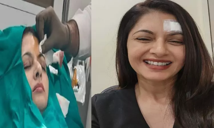 அடக்கடவுளே என்னாச்சு..! “நெற்றியில் 13 தையல்” மருத்துவமனையில் அனுமதிக்கப்பட்ட பிரபல நடிகை…!!