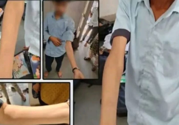 “இது என்னடா புது கேம்”.. பிளேடால் கையை வெட்டி கொண்ட 40 மாணவர்கள்…. இதை செய்யலனா 10 ரூபாய் அபராதமாம்… பெற்றோரை உறைய வைத்த சம்பவம்..!!