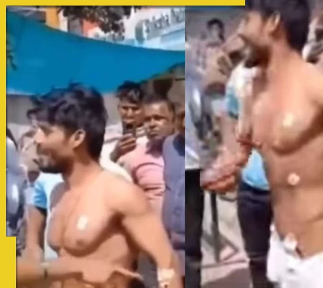 கோமாவில் இருந்த வாலிபர்…  ரூ.1 லட்சம் கேட்ட டாக்டர்கள்… திடீரென எழுந்து வந்து சொன்ன பகீர் தகவல்… இப்படியா சீட் பண்ணுவாங்க…? பரபரப்பு வீடியோ..!!