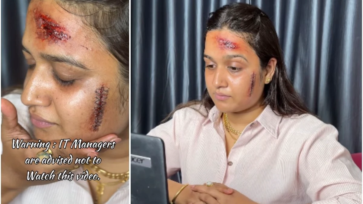 “Leave வேணுமா”..? அப்போ இதே மாதிரி பண்ணுங்க.. “ஆனா காயத்தை ஆறவே விடக்கூடாது”.. நீ பெரிய கேடி தாம்மா… வைரலாகும் வீடியோ..!!