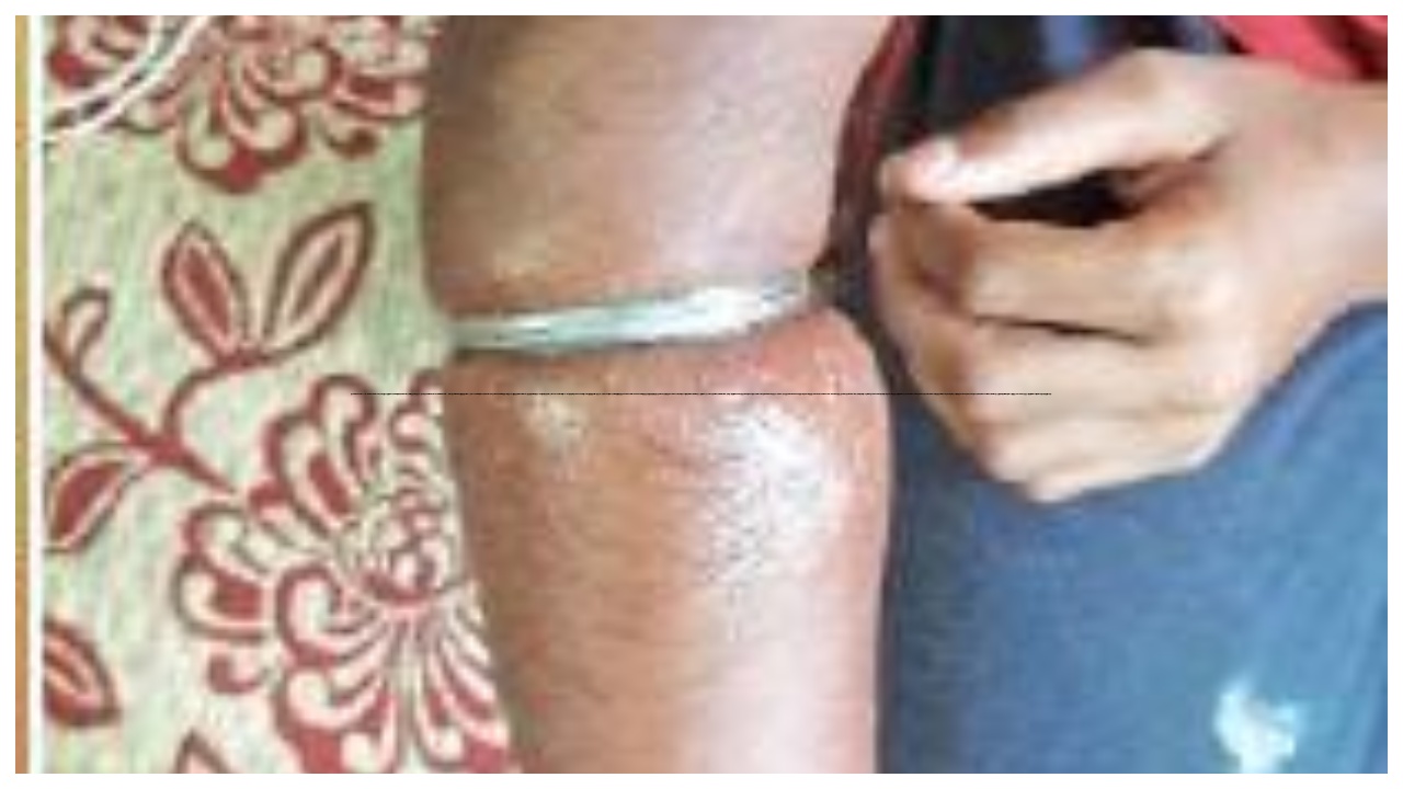 “நகைக் கடை… ஒர்க்ஷாப்…” கையில் காப்பு சிக்கியதால் மகனுடன் அலைந்த பெற்றோர்…. அதிர்ச்சி சம்பவம்…!!