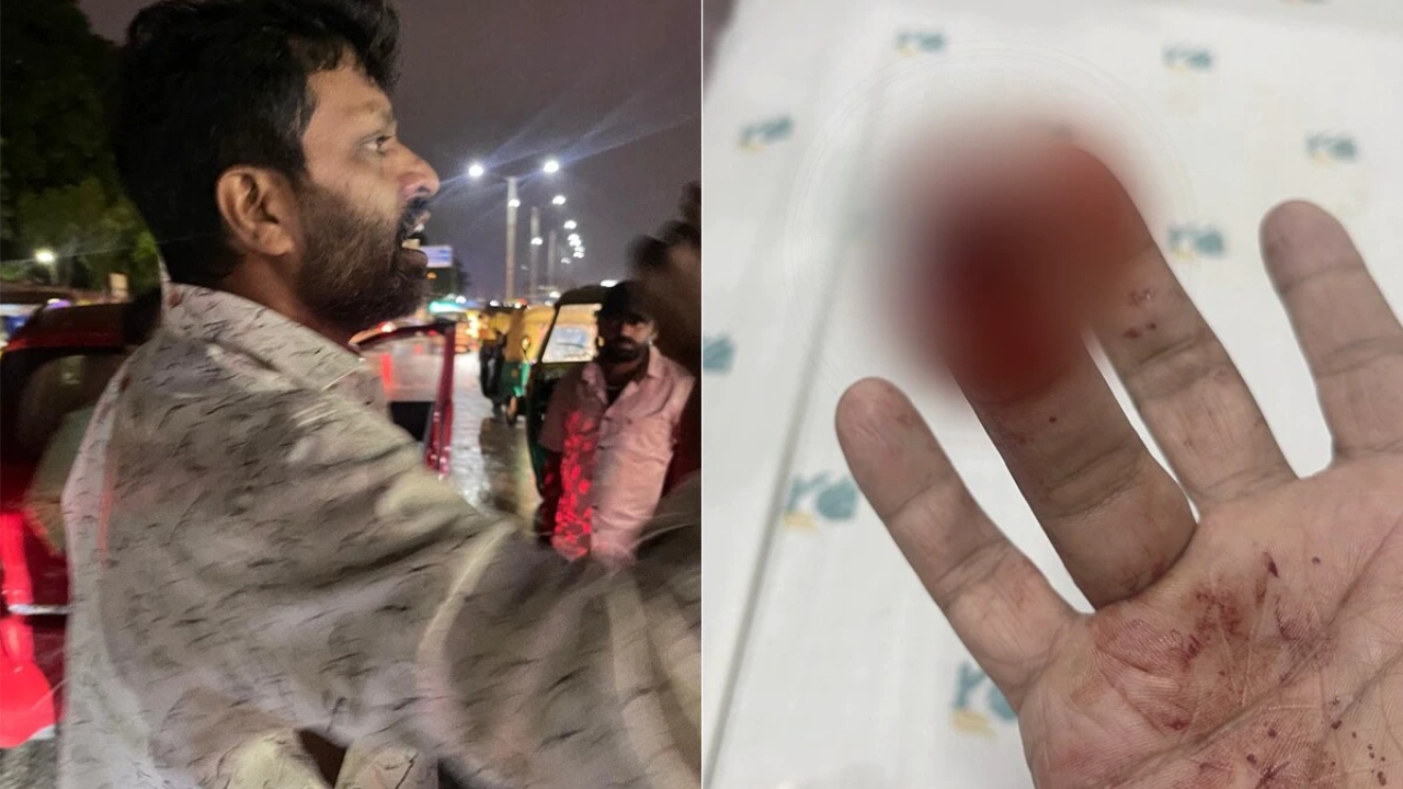 “மனைவி மீது சேற்று நீர் பட்டதால்…” கை விரலை கடித்து குதறி… நடுரோட்டில் நடந்த பயங்கர சண்டை…. பரபரப்பு சம்பவம்…!!