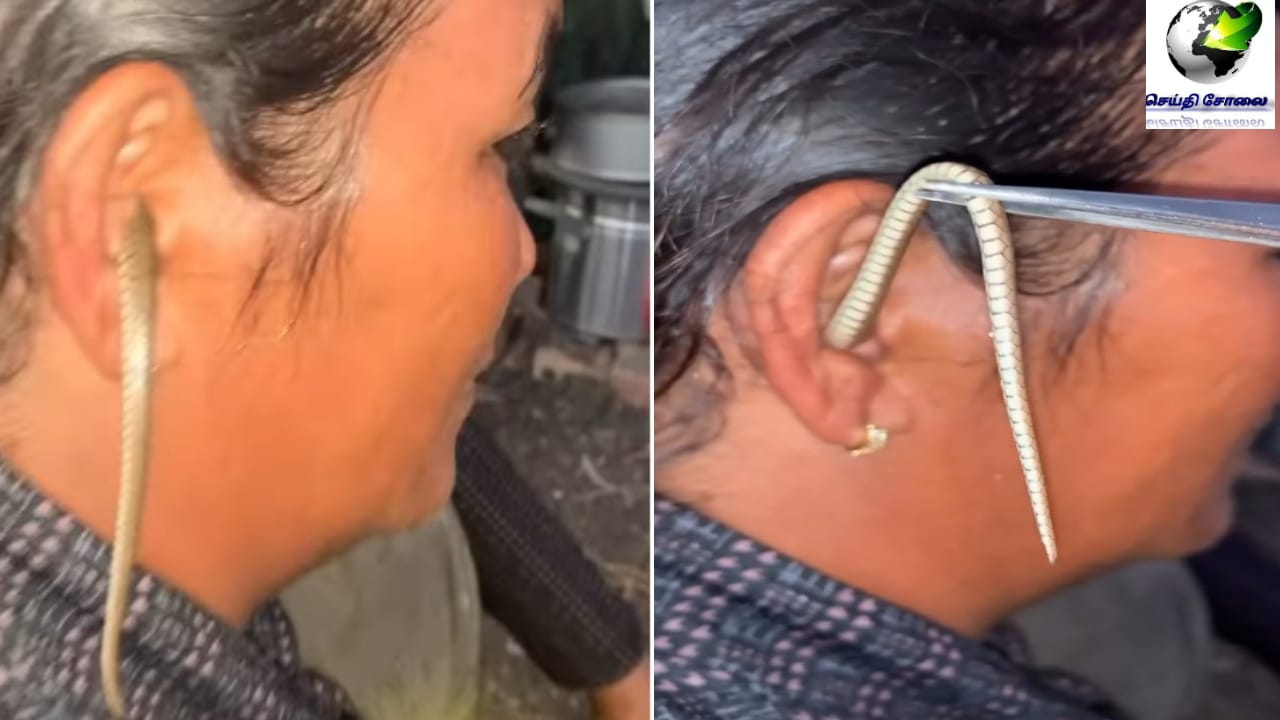 அம்மாடியோ…! காதுக்குள் நுழைந்த பாம்பு…. வலியில் துடித்த பெண்…. பதற வைக்கும் வீடியோ…!!