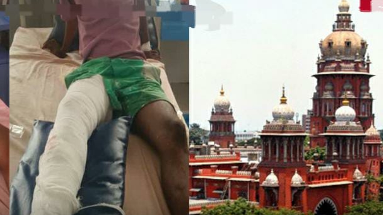 போலீஸ்காரர்கள் ஏன் வழுக்கி விழுவதில்லை…? குற்றம் சாட்டப்பட்டவர்களுக்கு கட்டு போடும் செயலுக்கு முற்றுப்புள்ளி வைங்க…. சரமாரியாக கேள்வி எழுப்பிய நீதிபதிகள்…!!