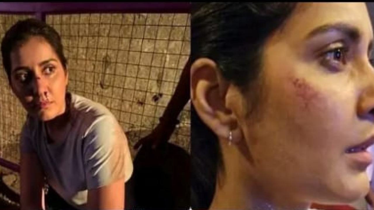 அதிர்ச்சி….! முகம், கையில் காயத்துடன் போட்டோ பதிவிட்ட நடிகர் ராஷி கண்ணா…. அவருக்கு என்னாச்சு….?