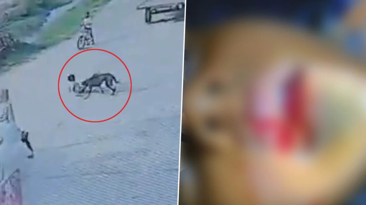 பார்த்தாலே பதறுது…! 7 வயது சிறுவனின் உதட்டை கடித்து குதறிய தெருநாய்…. பதைப்பதைக்கும் சிசிடிவி காட்சிகள்…!!