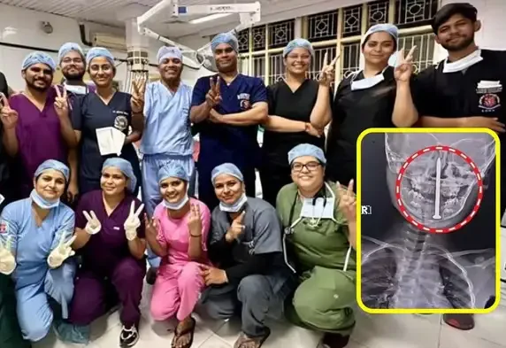 7 வயது சிறுமியின் தலையில் இருந்த ஆணி….. அறுவை சிகிச்சை மூலம் சிறுமியின் உடலை காப்பாற்றிய மருத்துவர்கள்…. குவியும் பாராட்டுக்கள்…!!!