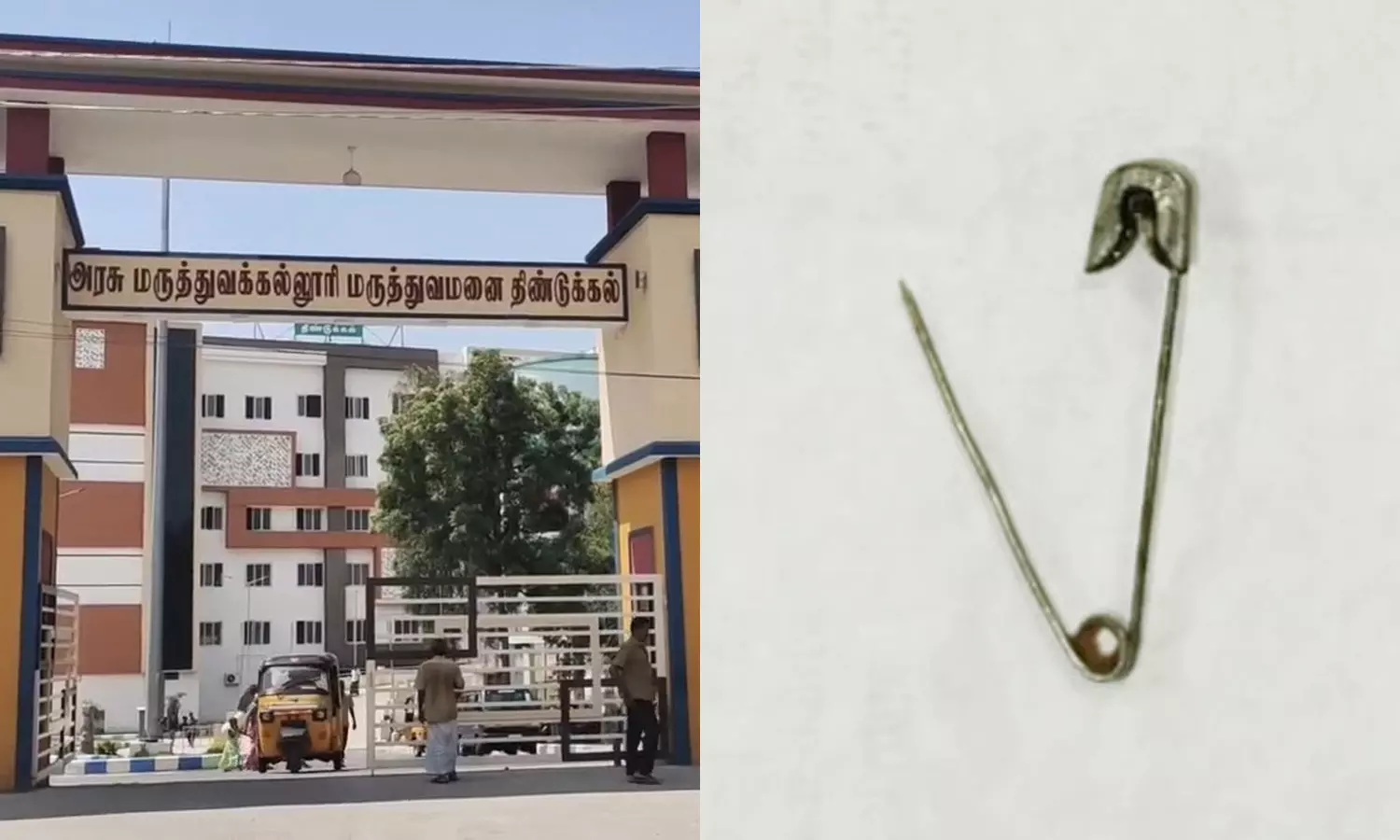 “13 வயது சிறுமியின் வயிற்றுக் குடலில் சேஃப்டி பின்”… 3 முறை முயற்சித்து முடியல… போராடி எடுத்த அரசு மருத்துவர்கள்…!!!!