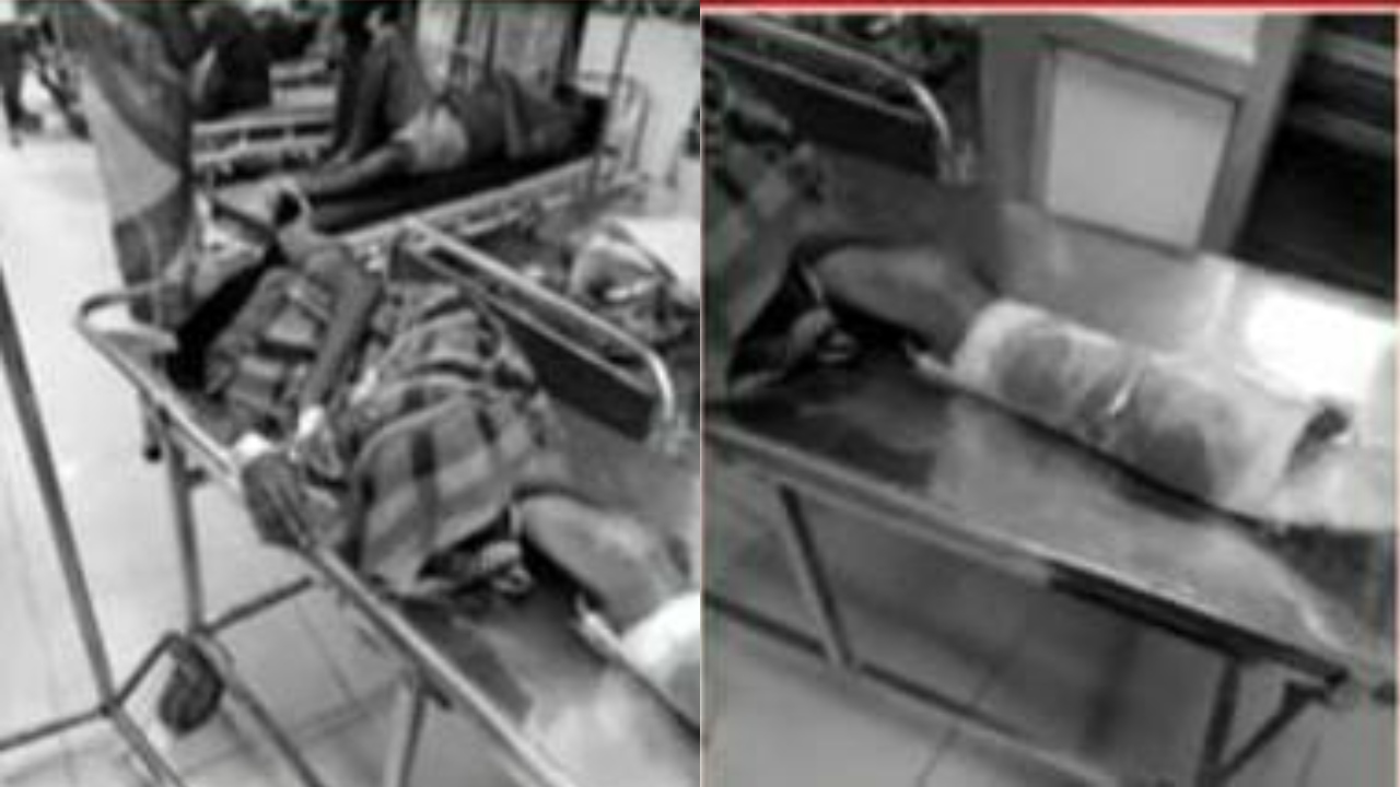 “பேருந்து சக்கரம் ஏறி நசுங்கிய கால்….” அலறி துடித்த மூதாட்டி…. கண்டுகொள்ளாத போக்குவரத்து துறை…. வேதனையில் உறவினர்கள்….!!
