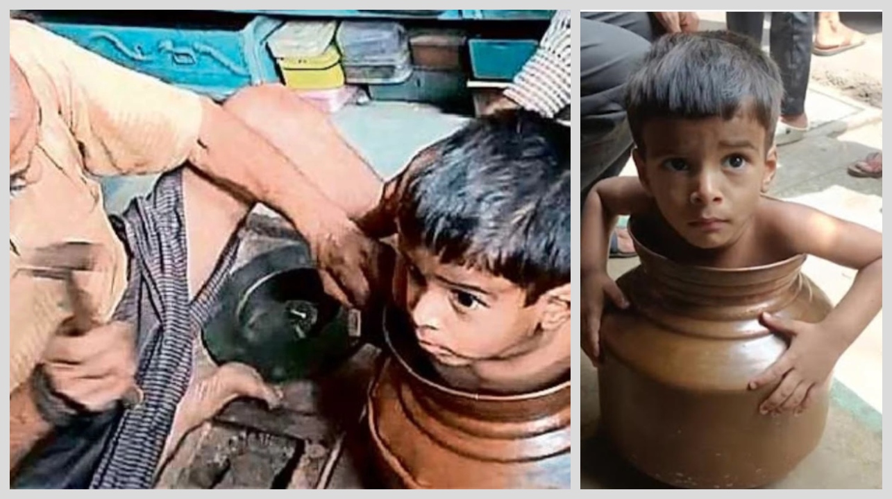 எப்புட்றா..! அதுக்குள்ள போய் உட்கார்ந்த.. தண்ணீர் நிரம்பிய செம்பு பாத்திரத்தில் சிக்கிய 4 வயது சிறுவன்… போராடி மீட்ட சம்பவம்… விளையாட வேற இடமே கிடைக்கலையா..?