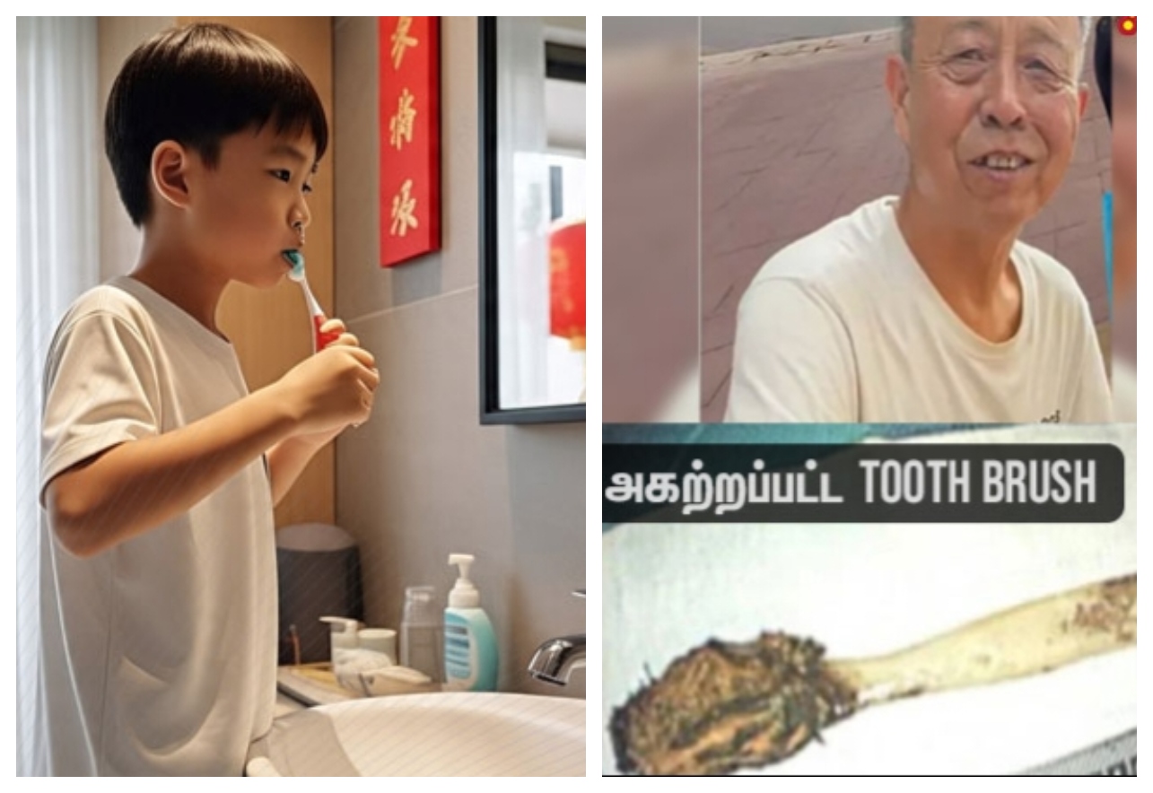 OMG: 52 வருடங்களாக வயிற்றில் இருந்த Tooth ப்ரஷ்… 12 வயதில் மிட்டாய் போல் விழுங்கியது 64 வயதில் ஆபரேஷன் மூலமாக அகற்றம்… வினோத சம்பவம்…!!!!