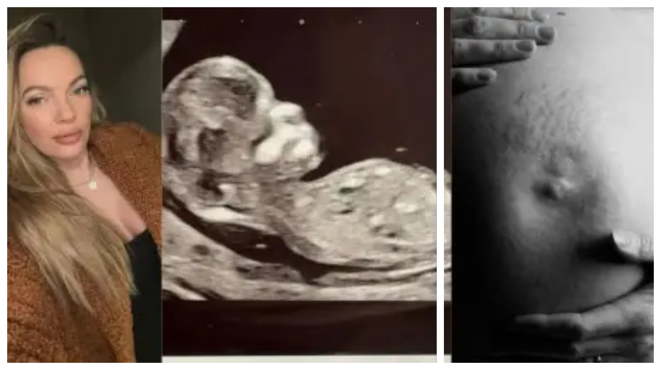 “உடலுறவு இல்லாமல், IVF சிகிச்சை இல்லாமல் தானாகவே கர்ப்பமடைந்த குழந்தை பெற்றெடுத்த பெண்”.. அட உண்மைதாங்க.. இங்கிலாந்தில் நடந்த வினோதம்..!!!