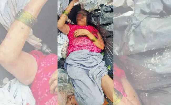 “தோல் புற்று நோயால் பாதிக்கப்பட்ட பாட்டி”… குப்பையில் தூக்கி வீசிய பேரன்… ஒரு ஹாஸ்பிடலில் கூட அனுமதிக்கல… போராடி மீட்ட போலீசார்… நெஞ்சை நொறுக்கும் சம்பவம்…!!!!