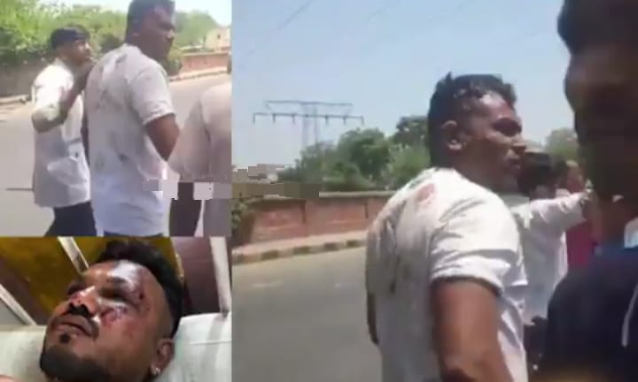 அகமதாபாத் விமான விபத்து….! உயிர் தப்பி பதற்றத்துடன் நடந்து சென்ற நபர்…. பரபரப்பு சம்பவம்…!!