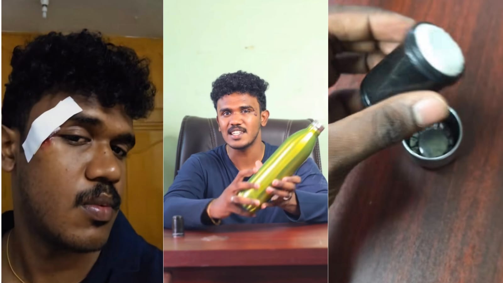 “கொஞ்சம் விட்ருந்தா என் கண்ணே போயிருக்கும்” திடீரென வெடித்த FLASk… வைரலாகும் வீடியோ…!!
