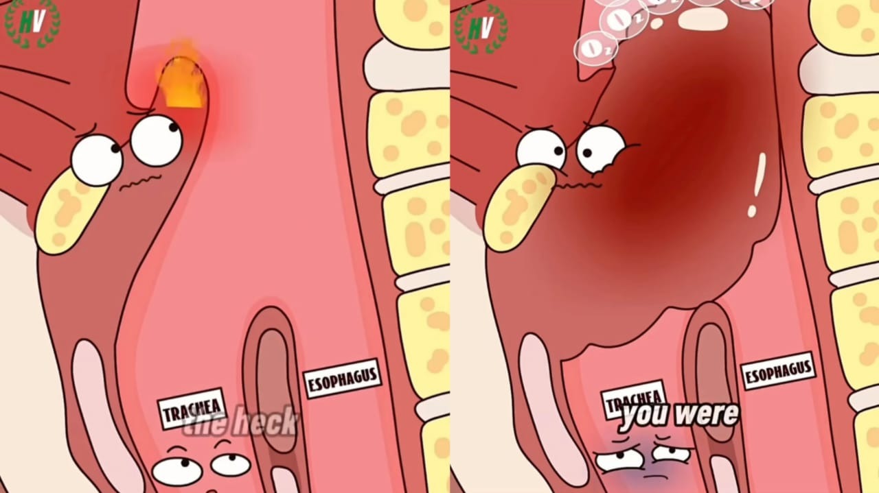ரொம்ப சூடான உணவை சாப்பிட்ட பிறகு ஐஸ் வாட்டர் குடிக்கலாமா..? அதனால என்ன ஆகும்… வைரலாகும் வீடியோ…!!!!