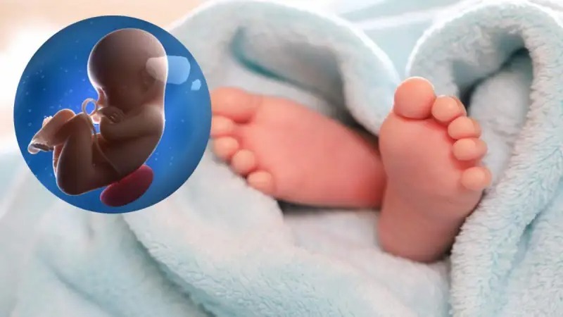 5 லட்சத்தில் 1 தான் இப்படி…. பிறந்த பச்சிளம் குழந்தை வயிற்றில் கரு…. மருத்துவர்கள் SHOCK….!!
