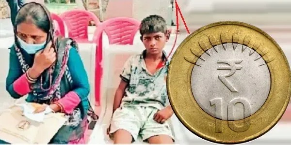 ஐயோ கடவுளே…. விளையாட்டில் COIN-ஐ விழுங்கிய சிறுவன்…. 15 நிமிடத்தில் காப்பாற்றிய மருத்துவர்கள்….!!
