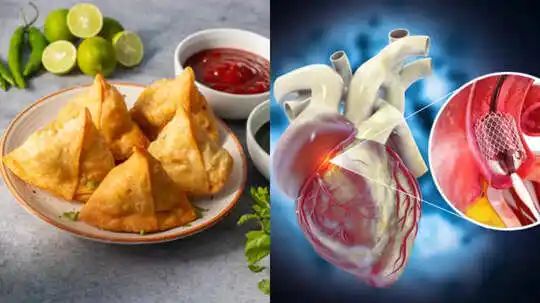 எச்சரிக்கை!! ₹20 சமோசா சாப்பிட்டால் ₹3,00,000 லட்சம் செலவாகுமா….? மருத்துவரின் பகீர் எச்சரிக்கை….துரித உணவால் வரும் ஆபத்து….!!