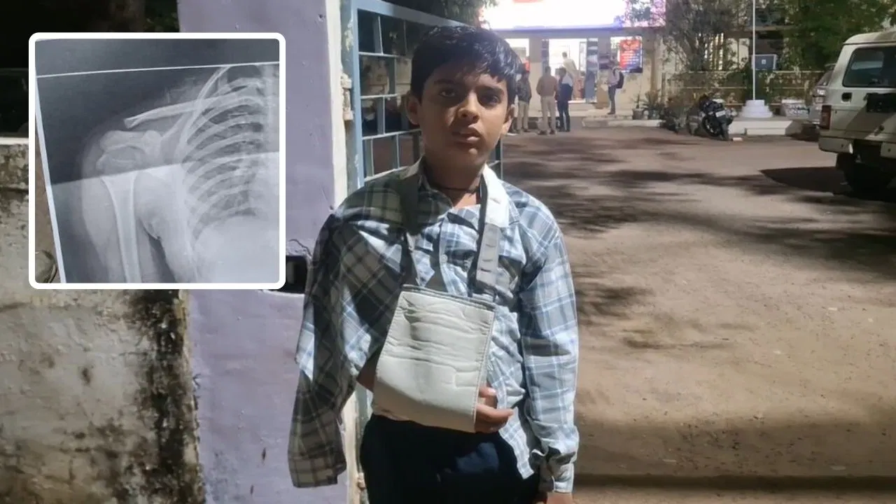 “ஸ்கூலுக்கு புக் எடுத்துட்டு வரல”… அதுக்குன்னு இப்படியா?… 12 வயது சிறுவனை கொடூரமாக தாக்கி… அதிர்ச்சி சம்பவம்…!!