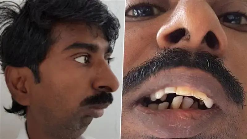 பரிதாபமா? கேலியா? மனிதநேயத்தை மறந்து வேட்டையாடும் நெட்டிசன்கள்! மருத்துவர் செய்த மகத்தான உதவி….  உண்மையான கதை தெரிந்தால் அதிர்ச்சியடைவீர்கள்..!!!