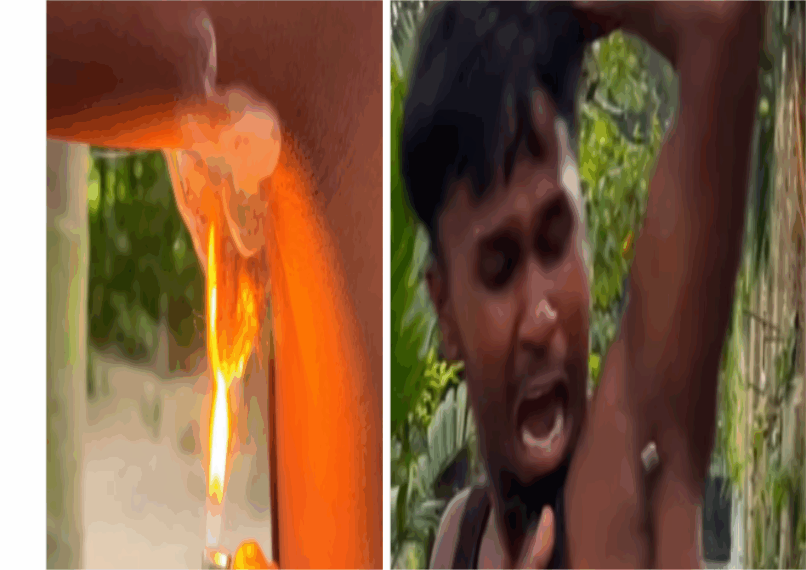 ‘இது விளையாட்டு அல்ல!’ – அக்குள் முடியை எரித்து நண்பன் செய்த கொடுமை! வலியில் துடித்த இளைஞர் – வைரலாகும் வீடியோ!