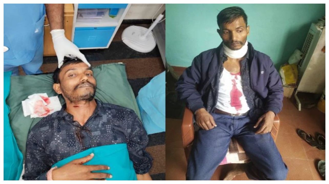 மரண தூதுவனாகும் சீன மாஞ்சா… ஹெல்மெட் அணிந்திருந்தும் கழுத்து அறுபட்ட அவலம்… உங்கள் உயிருக்கு உலை வைக்கும் ஒரு நூல்… இதோ நேரடி சாட்சி…!!!