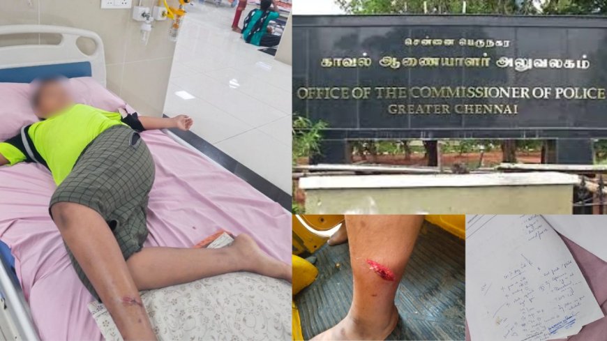 “ஒளிச்சு வச்சிருக்காங்க நீதி வேணும்!”.. 10 வயது சிறுவனை கடித்து குதறிய நாய்.. உரிமையாளர் செஞ்ச வேலை!.. சென்னையில் பரபரப்பு..!!!