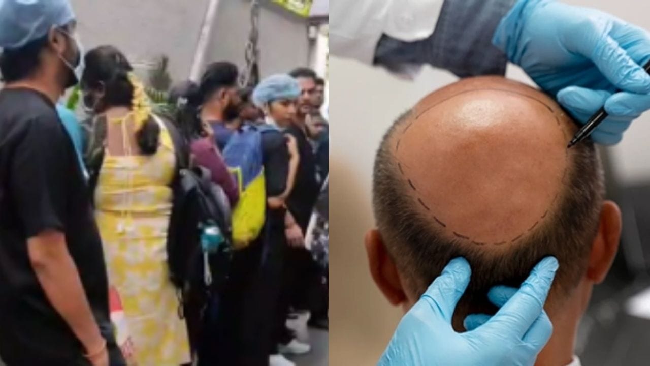 தலைமுடி சிகிச்சையில் நடந்த பயங்கரம்.. ‘டாக்டர்’ என்று நம்பி ஏமாந்த பெண்.. அம்பலமான ‘மிஸ்டர் ஹேர் கிளினிக்’ பகீர் மோசடி.. சென்னையில் வசமாகச் சிக்கிய போலி கும்பல்..!!