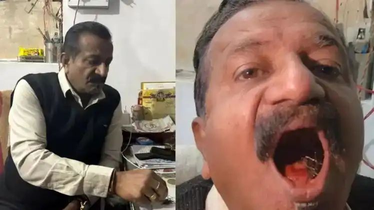 45 வருஷமா வாய்க்குள் 150 கூர்மையான ஊசிகளுடன் வாழும் நபர்… ஒரு கீறல் கூட இல்லை… அதிர்ச்சியில் உறைந்த மருத்துவர்கள்… வினோத சம்பவம்…!!!