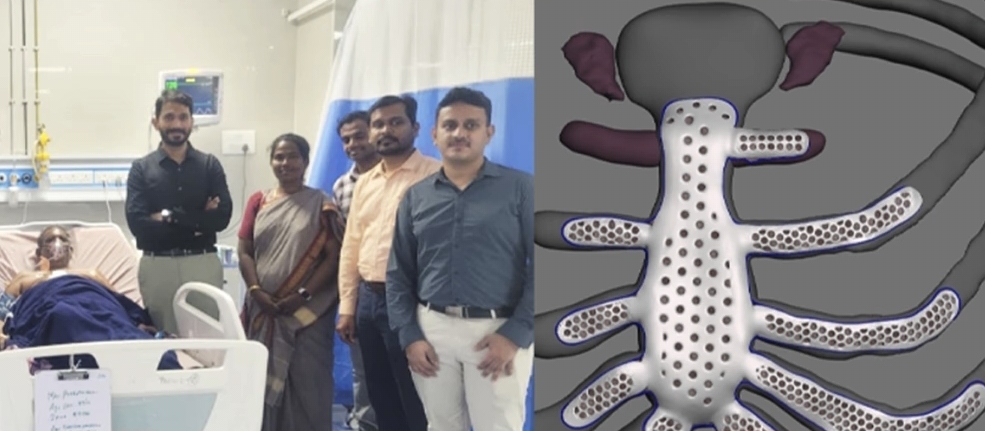 “இனி இவருக்கு இரும்பு விலா எலும்பு” கேன்சரை விரட்டியடித்த கலைஞர் மருத்துவமனை…. அறுவை சிகிச்சையில் அசத்திய சென்னை டாக்டர்கள்….!!