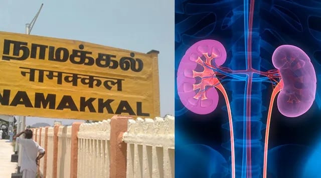 Breaking: தமிழகத்தை உலுக்கிய கிட்னி திருட்டு வழக்கில் திடீர் திருப்பம்…! மகாராஷ்டிரா விவசாயிகளையும் விட்டு வைக்கலயா..? பரபரப்பு தகவல்கள்..!!