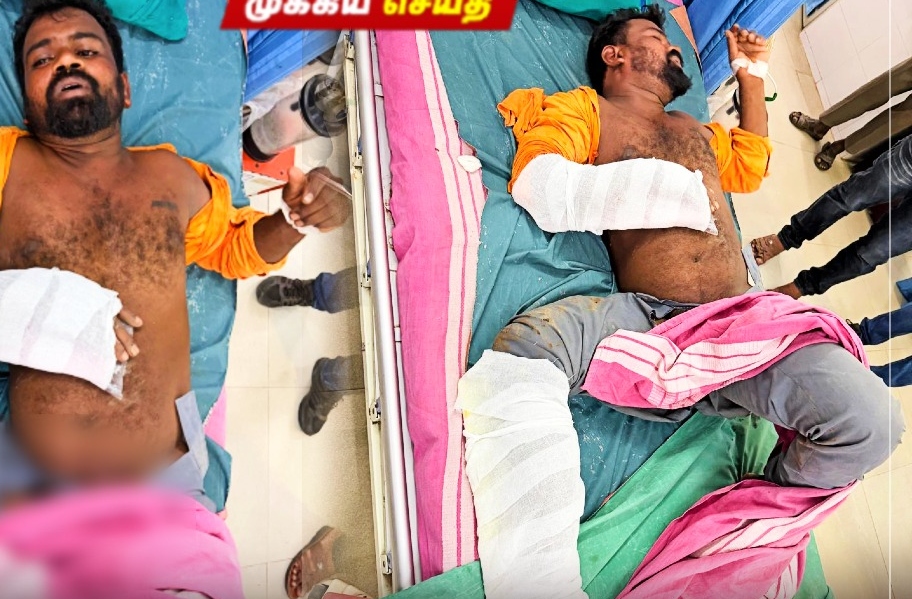 “கோவை சிறுமி மரண வழக்கு!”… தப்பியோட முயன்ற முக்கிய குற்றவாளி கார்த்திக்கு விழுந்தது ‘மாவுக்கட்டு’… வைரலாகும் பரபரப்பு போட்டோ..!!!