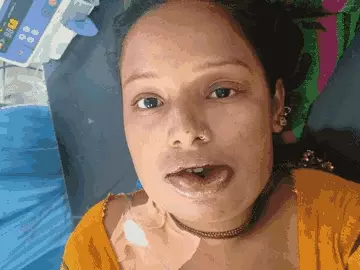 “மஞ்சள் பூசியதால் வென்டிலேட்டருக்குப் போன மாப்பிள்ளை!” – கல்யாண வீட்டில் நடந்த பயங்கரம்.. சந்தையில் விற்கப்படும் மஞ்சளின் பகீர் பின்னணி..!!”