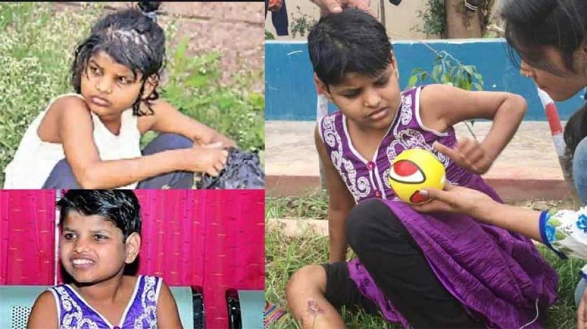 ஜங்கிள் புக் நிஜமான கதை… காட்டில் மீட்கப்பட்ட சிறுமி… ஆரால் 9 வருஷ போராட்டம் வீண்… உலகை விட்டே மறைந்தார் வன தேவதை…!!!!