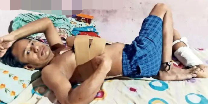 2 பேரின் உசுர காப்பாத்துனது ஒரு குத்தமா..? “படுத்த படுக்கையான வாலிபர்”.. சாப்பாட்டுக்கே வழியில்லாமல் பட்டினி கிடக்கும் குடும்பம்… அரசுக்கு உருக்கமான கோரிக்கை…!!