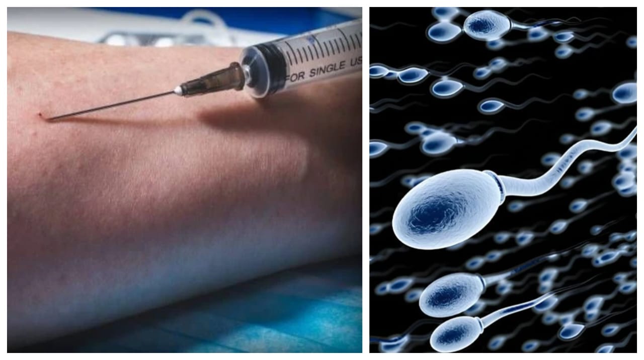 தன் விந்தணுவை ஊசி மூலம் கையில் செலுத்திய நபர்…! “இடுப்பு வலிக்கு விபரீத விந்தணு மருந்து”… மருத்துவ உலகையே அலற வைத்த விசித்திர வழக்கு…!!