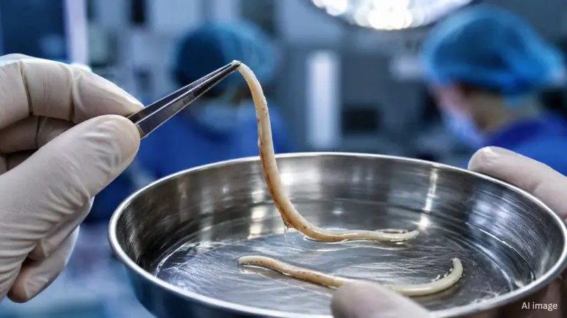 கையில் உருண்ட முட்டை…! “ஆப்ரேஷன் செய்த டாக்டருக்கு காத்திருந்த பேரதிர்ச்சி… உயிரோடு இருந்த புழுக்கள்… தவளை கறி சமைத்ததால் நடந்த பயங்கரம்… பகீர் எச்சரிக்கை…!!!