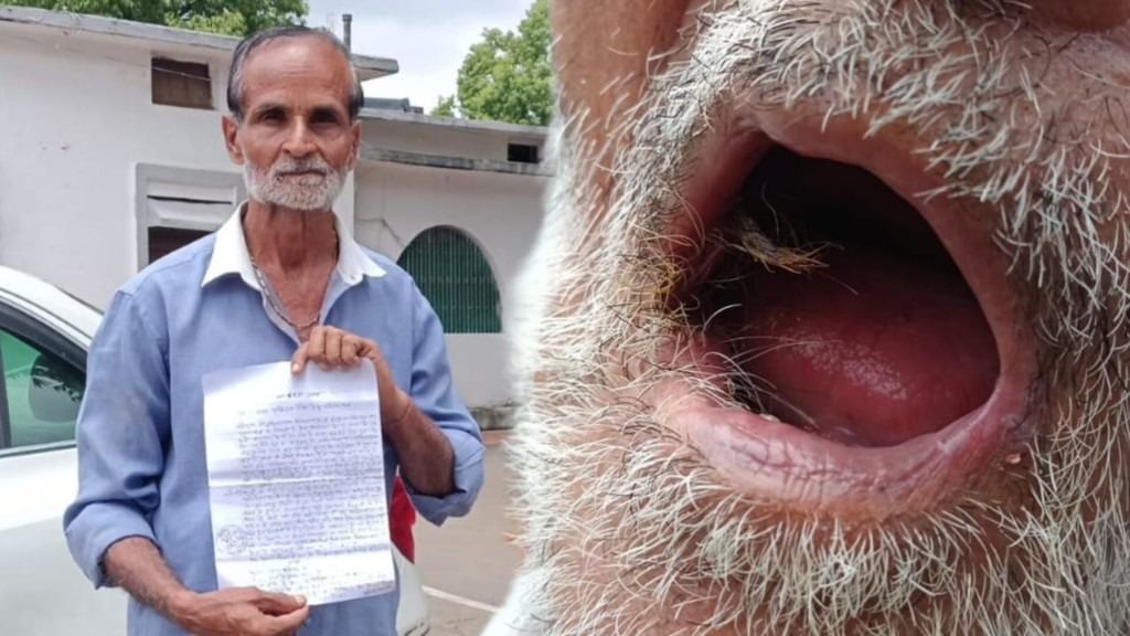 ரொம்ப ஏழை..! 56 வயசு ஆகுது… 27 மாசமா வாய்க்குள் வளரும் முடி.. டாக்டரின் அலட்சியத்தால் வாழ்க்கையை நரகமாகிய சோகம்… ஆனால் ஒருத்தர் கூட ஆக்சன் எடுக்கல… 2 வருஷமா நீதிக்காக ஏங்கும் வியாபாரி..!!!