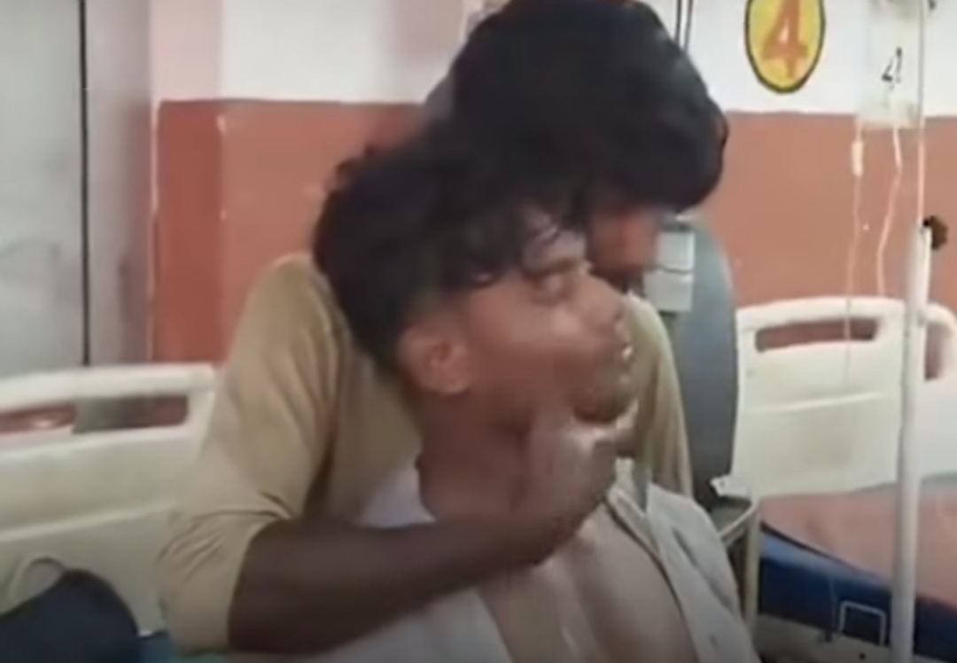“தூங்கிடாதடா தயவுசெஞ்சு” பாம்பு கடித்த தம்பிக்கு 150 அறை கொடுத்த அண்ணன்….  வைரலாகும் பாச போராட்டம்….!!