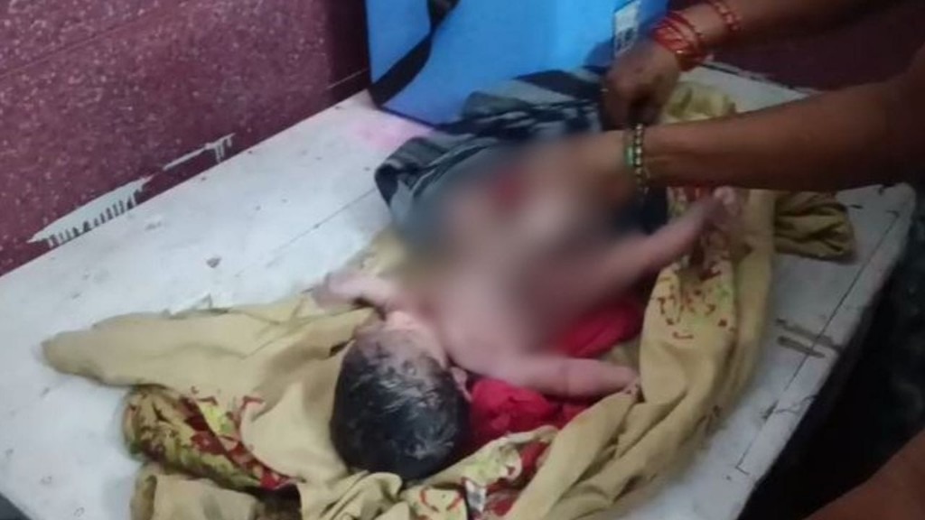 தாயின் கருவறையில் நடந்த அதிசயம்…! 4 கைகள், 4 கால்களுடன் பிறந்த அதிசய குழந்தை… இயற்கையின் விசித்திர படைப்பு… டாக்டர்கள் சொன்ன பகீர் உண்மை… ஆச்சரிய செய்தி…!!