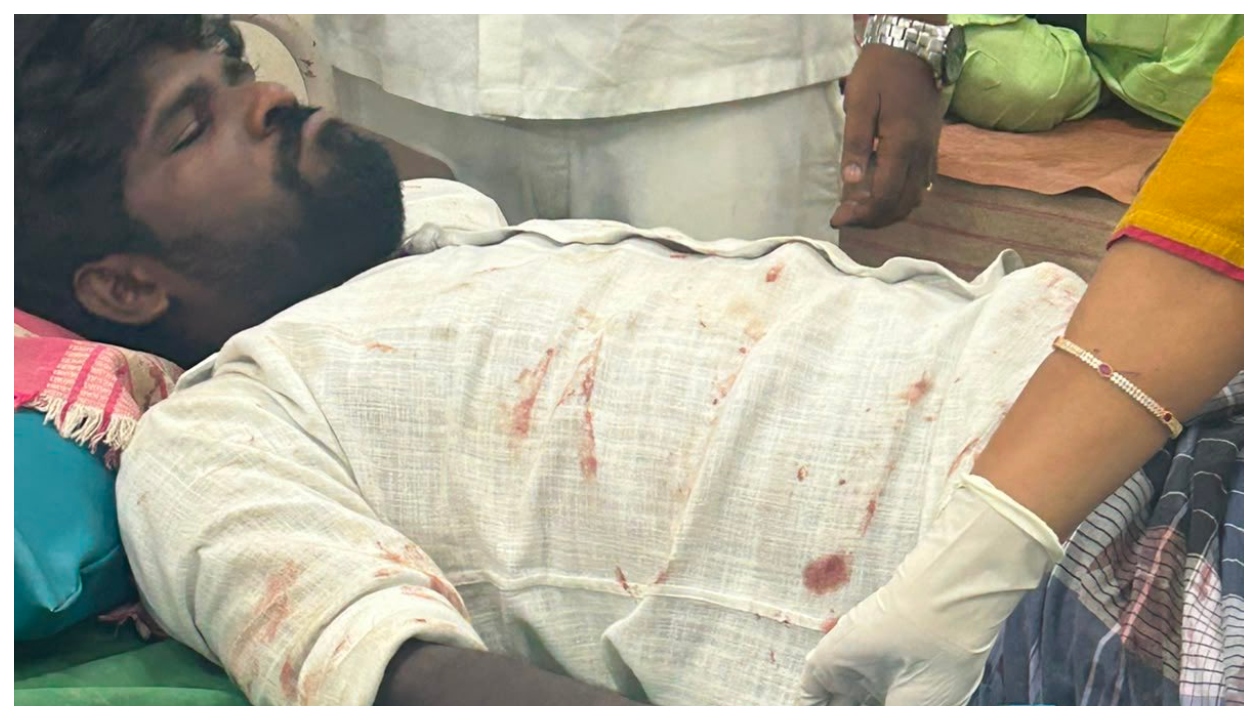 “தடுக்க முயன்றபோது அறுந்து விழுந்த கை…” மேலவளவில் மீண்டும் அரங்கேறிய அதிர்ச்சித் தாக்குதல்… மதுரையில் நடந்த பகீர் சாதிவெறித் தாக்குதலின் பின்னணி என்ன?”